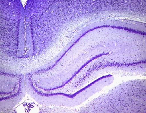 Hippocampus of the Rat | SynapseWeb