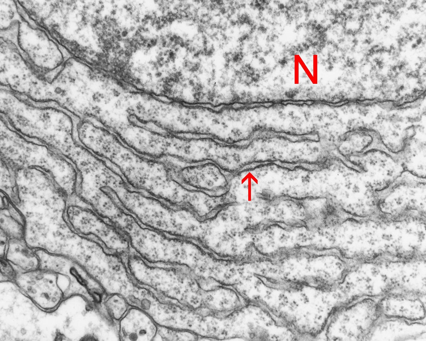  ER-in-neuronal-perikaryon-1.jpg