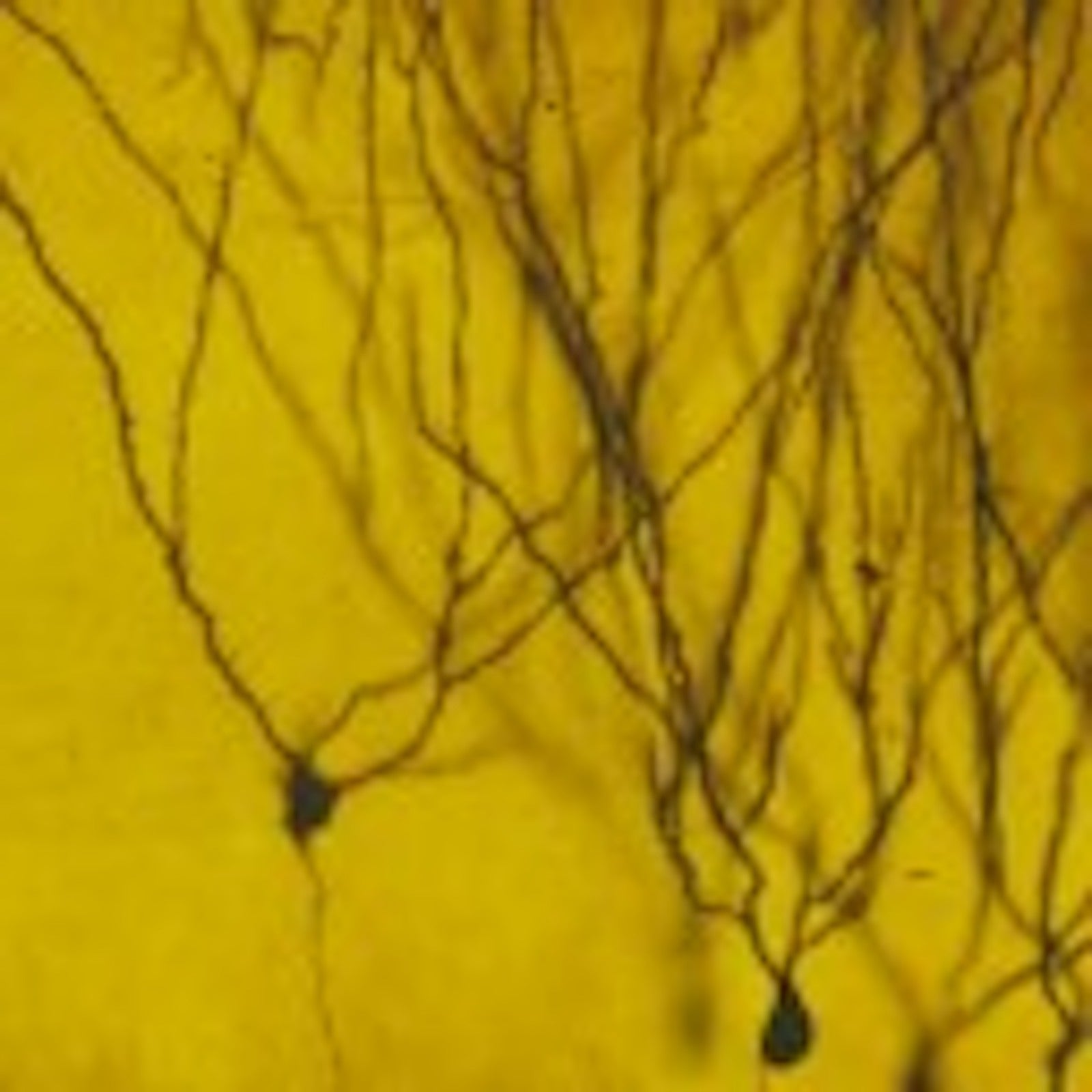 golgi