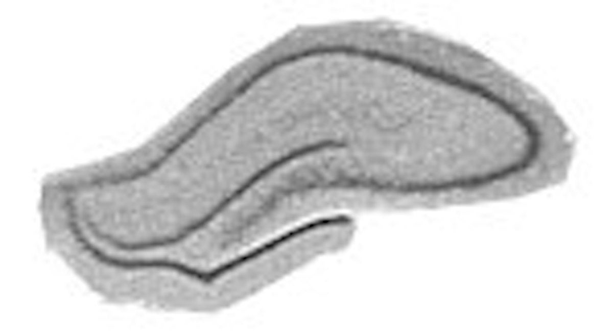 rat brain hippocampus
